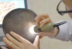 頭發微量元素檢測儀工程師解剖血液樣本與頭發檢測微量元素