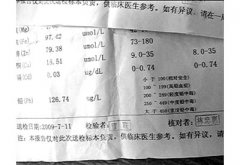 血鉛檢測儀介紹造成小兒鉛含量高的原因引起家長注意